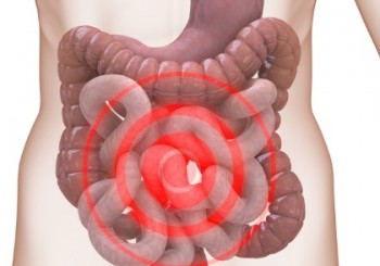 La sindrome del colon irritabile